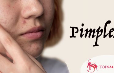 blog-grid-1-410x308